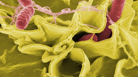 Salmonella bacteria under the microscope. Image: NIAID via Wikimedia Commons (File:SalmonellaNIAID.jpg), Public domain.