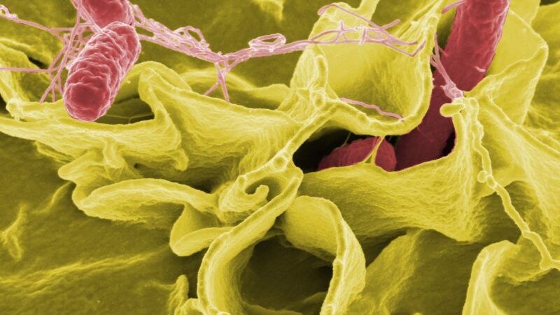 Salmonella bacteria under the microscope. Image: NIAID via Wikimedia Commons (File:SalmonellaNIAID.jpg), Public domain.